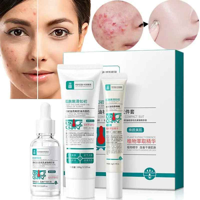 Fernglow Aloe Vera Skincare for Blemish-Prone Treatment - Fernglow
